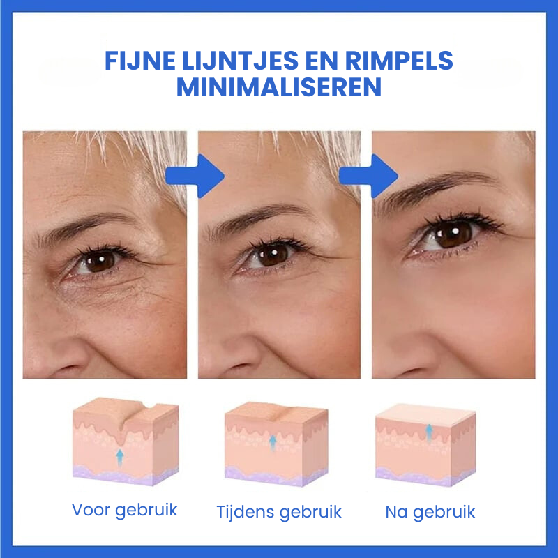 SkinLift™ | Botox Gezicht Serum Magic