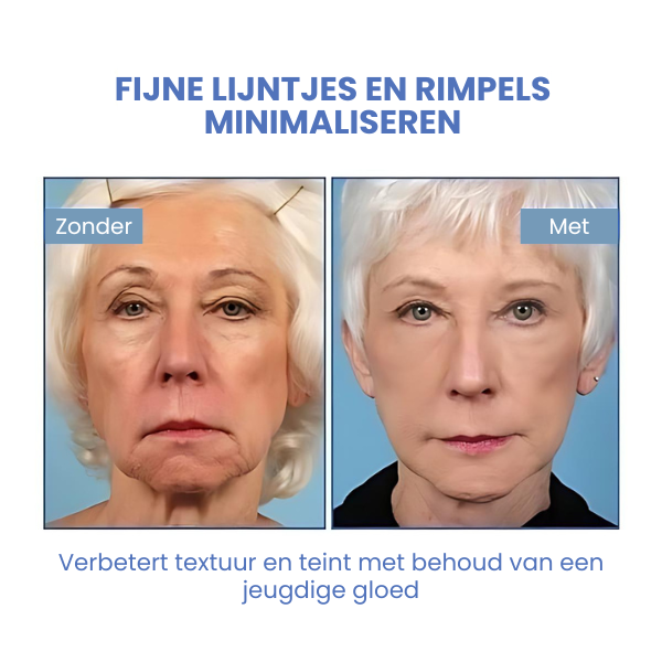 SkinLift™ | Botox Gezicht Serum Magic