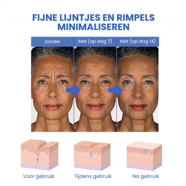 SkinLift™ | Botox Gezicht Serum Magic