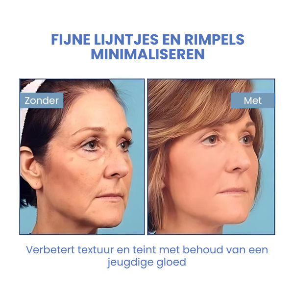 SkinLift™ | Botox Gezicht Serum Magic