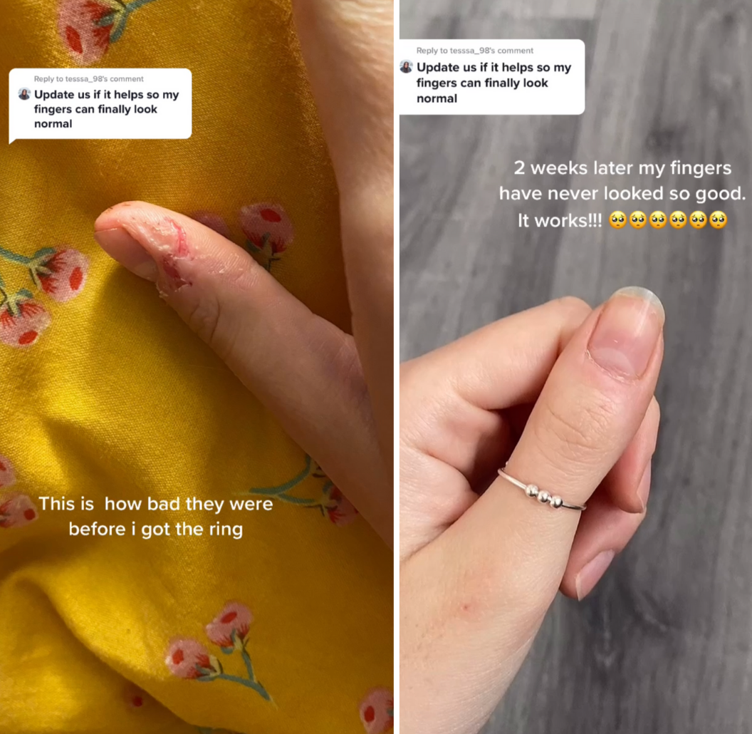 Anti-Stress ring in 3 kleuren!